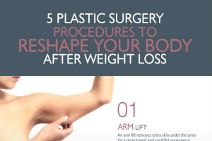 5 Plastic Surgery Procedures to Reshape Your Body after Weight Loss [Infographic]